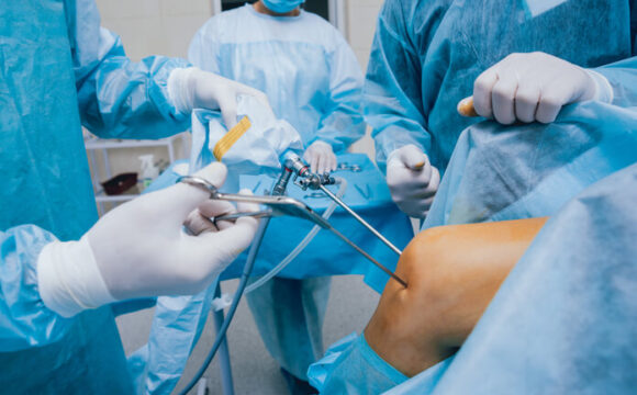 Arthroscopic Surgery